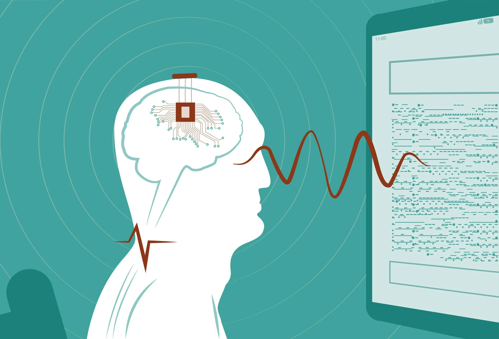 China Clears Brain-Computer Interface Chips for Commercial Use as It Moves to Lead the Global BCI Market