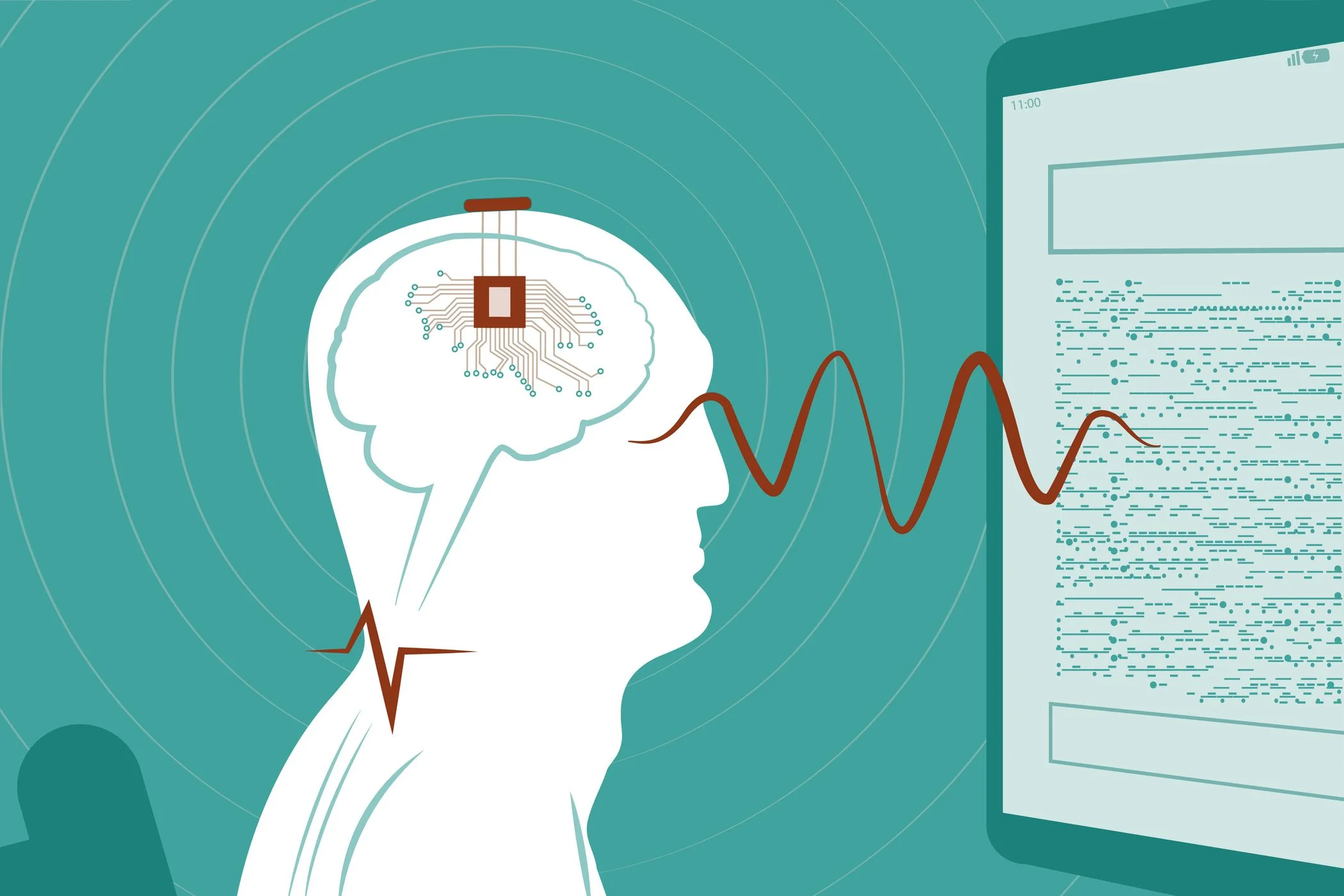 China Approves the First Brain Chips for Sale—and Has a Plan to Dominate the Industry